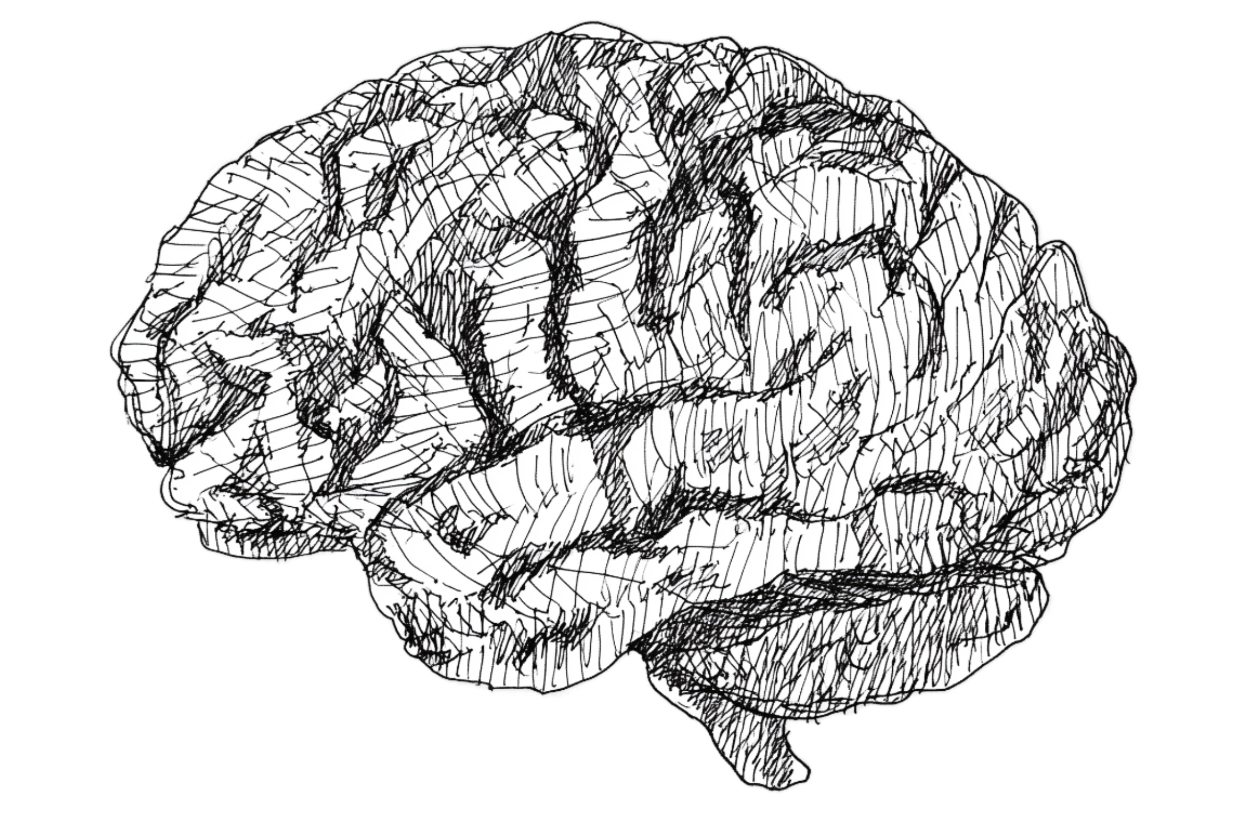 Averris Brain